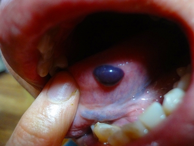 [写真あり] 舌に血豆のようなものが出来ています。受診が必要ですか？ | 歯チャンネル歯科相談室