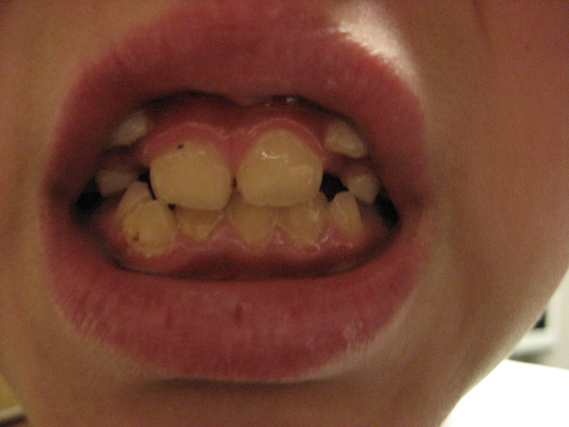 変 な ところ から 歯 が 生え てき た 赤ちゃん