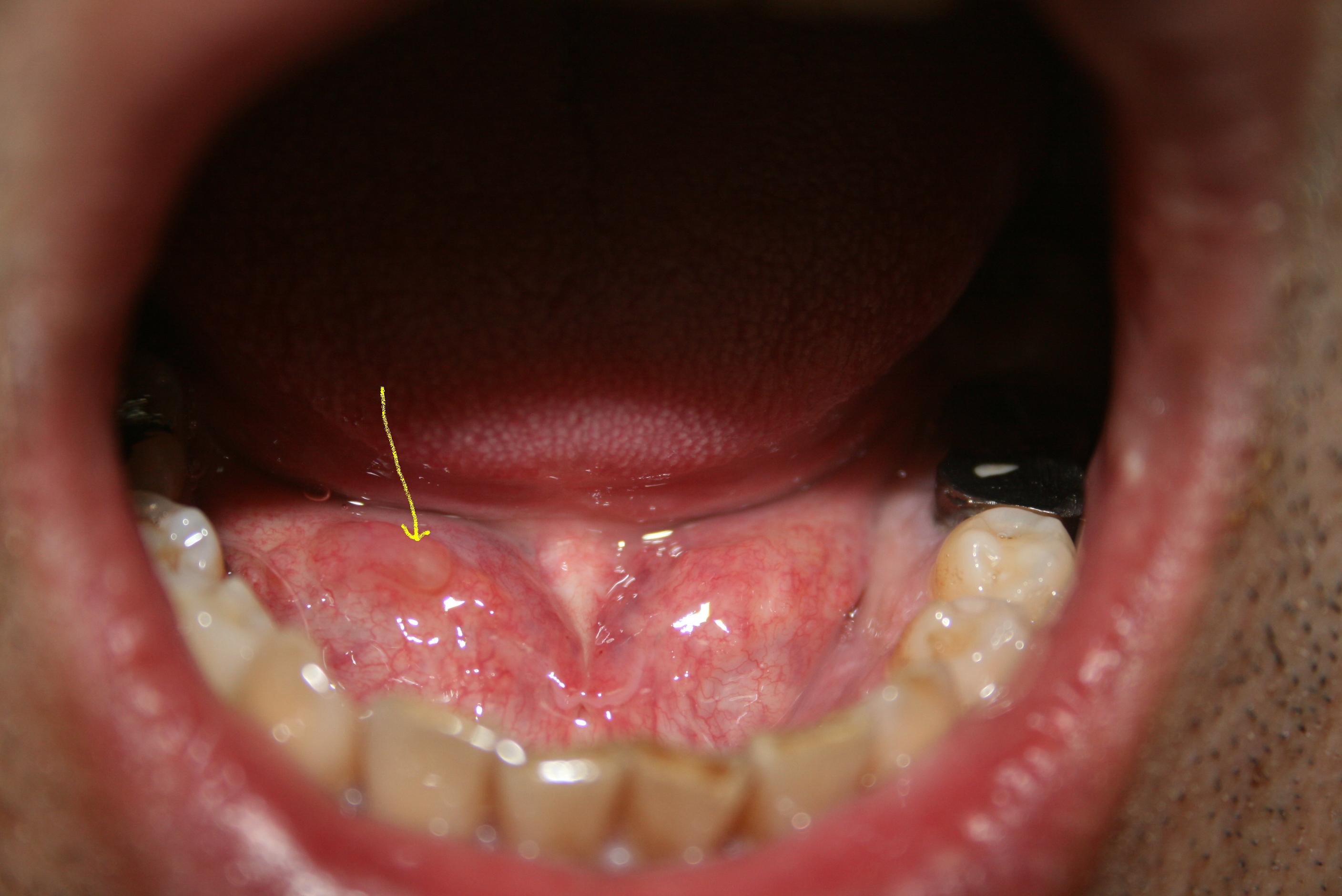 6.舌下腺-长爪沙鼠组织学-图片