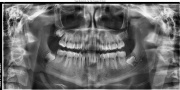 2024.07.16@dental@X-ray s.jpg