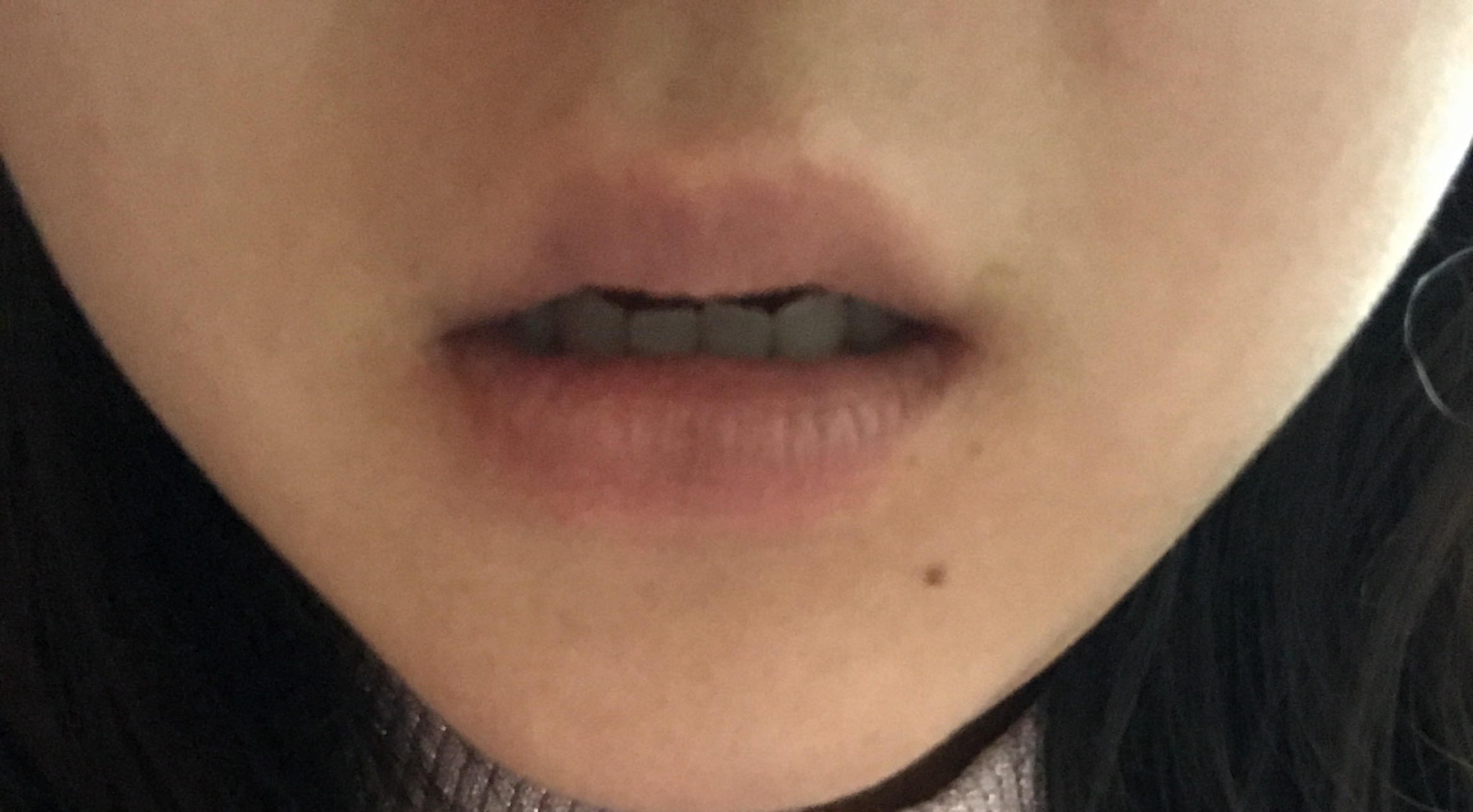 写真あり 口を半開きにすると上顎の歯の露出が少ない 歯チャンネル歯科相談室