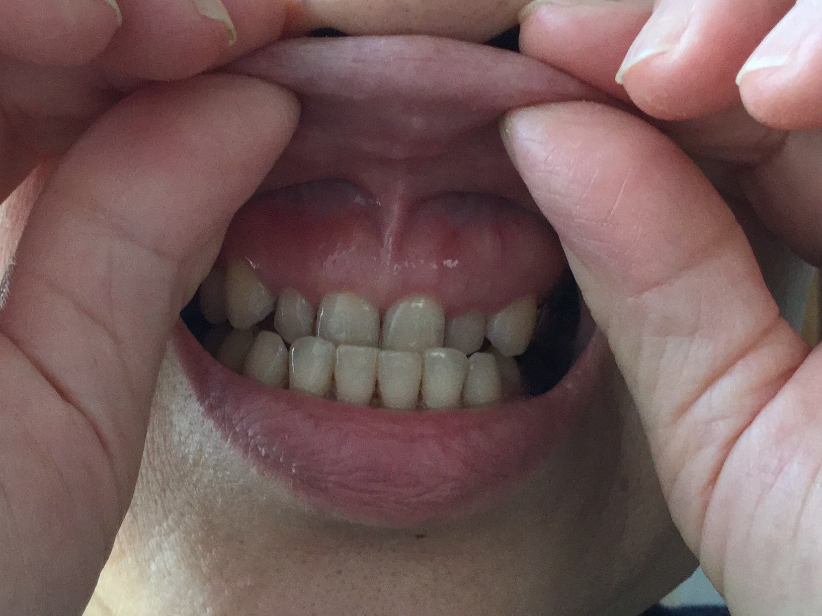 痛い と 歯茎 押す を 【歯茎が痛い】 歯茎の痛みからわかる、原因の見分け方と対処方法【歯茎の教科書】