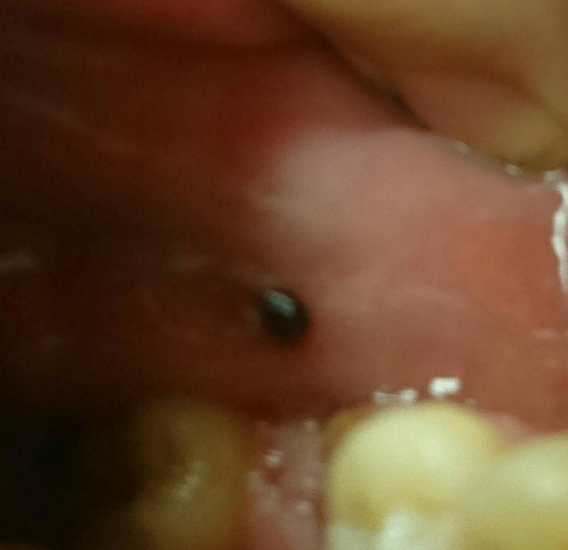 に 血豆 歯茎 口腔内に血豆が突然できた！これって何？潰してもいいの？