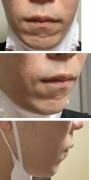 摜2