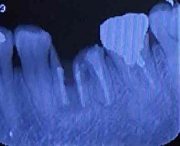 摜2