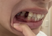�摜2