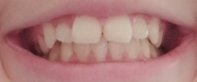 �摜1